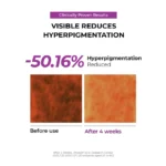 JUMISO - cremă de noapte pentru pete pigmentare și controlul sebumului Niacinamide 5+ Overnight Cream - imagine 4